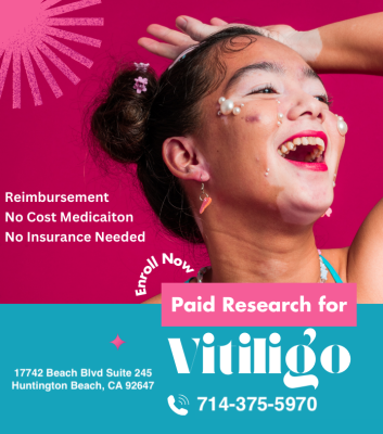 Vitiligo Research Study